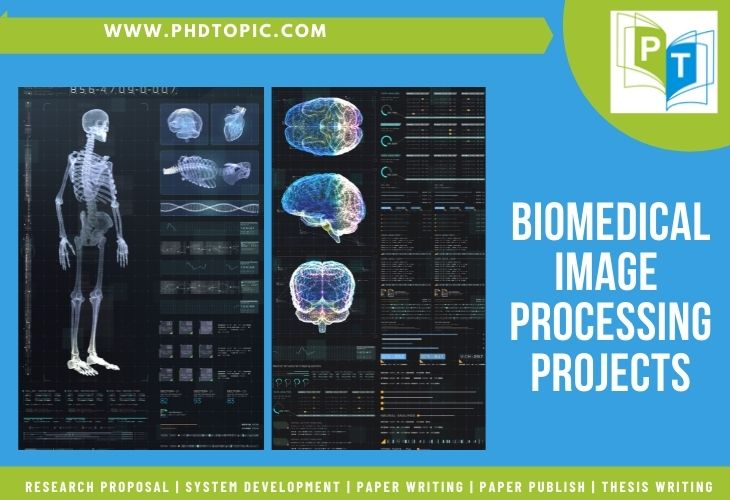 Biomedical Image Processing Projects Explained