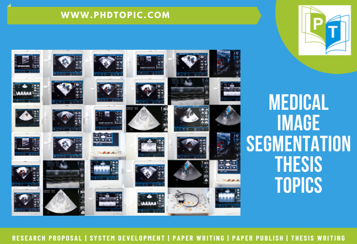 Medical Image Segmentation Thesis Topics List 