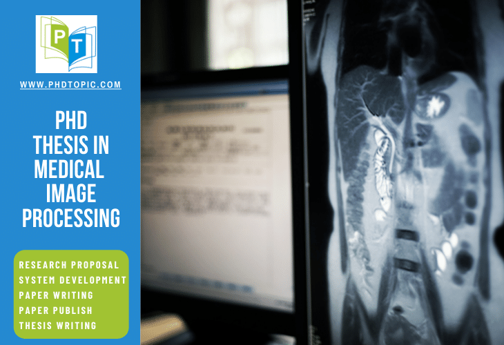 phd thesis on medical image processing