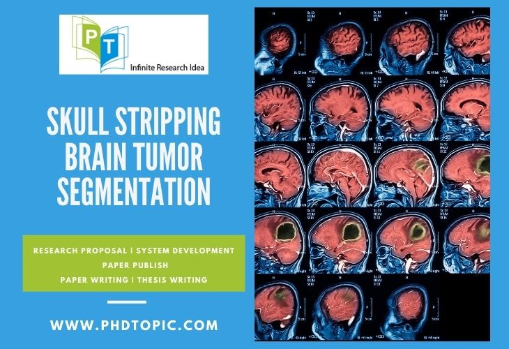 Innovative Novel Skull Stripping Brain Tumor Segmentation